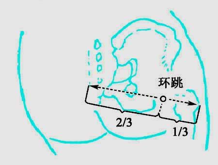 還跳穴|環跳穴